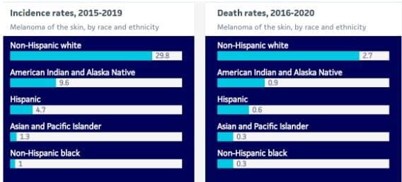 melanoma in black skin​