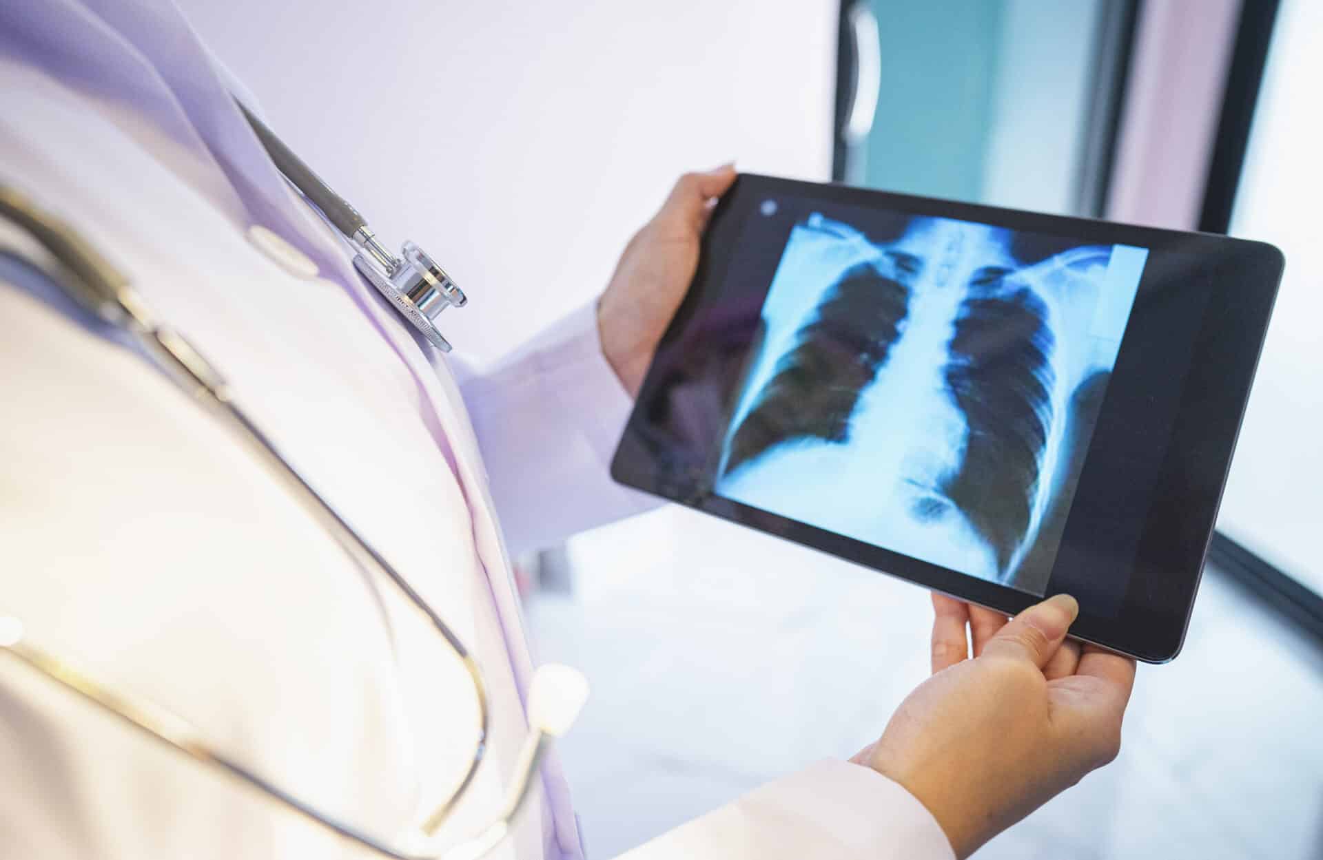 FDA Approves This New Drug for Deadly Lung Cancer