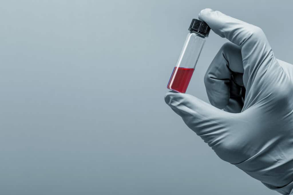CDC Warns of Shortage of Bottles Needed for Crucial Blood Tests, blood supply crisis