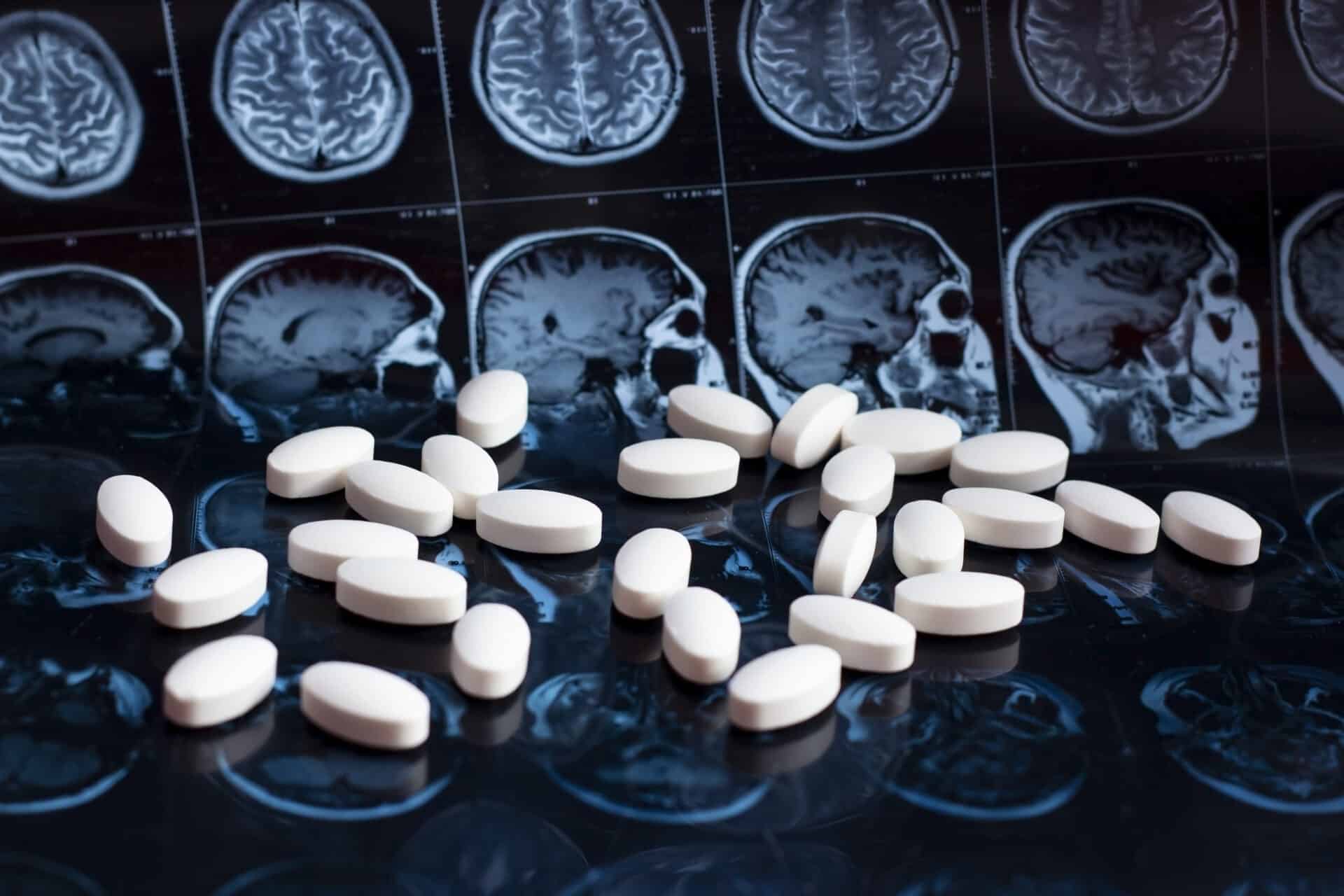 This Alzheimer's Drug May Also Slow Lewy Body Dementia