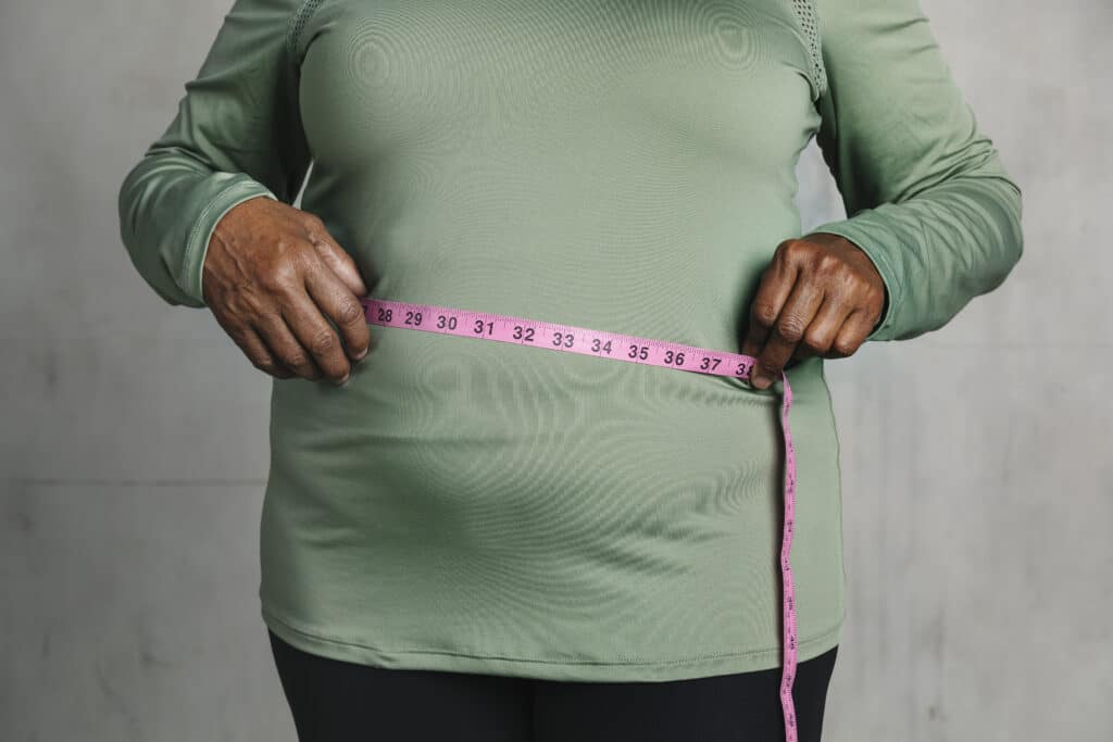 Black Patients Are Less Likely to Get Weight Loss Surgery