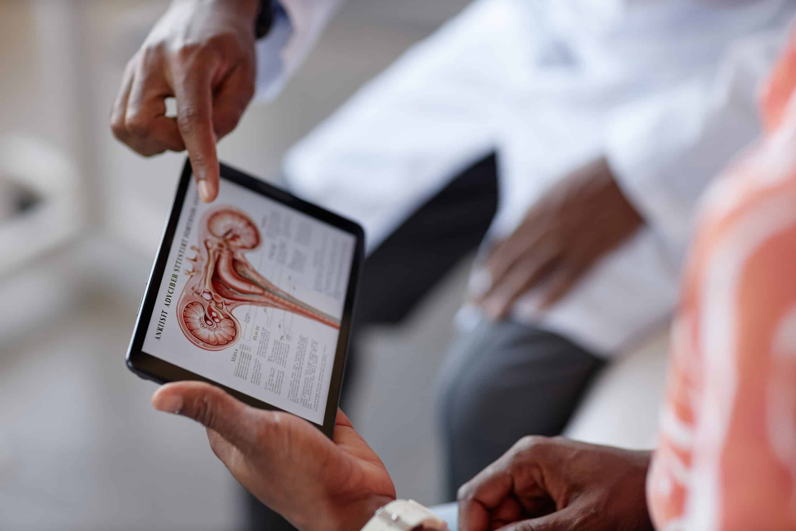 Ovarian Cancer Test May Miss This Antigen in Black Patients