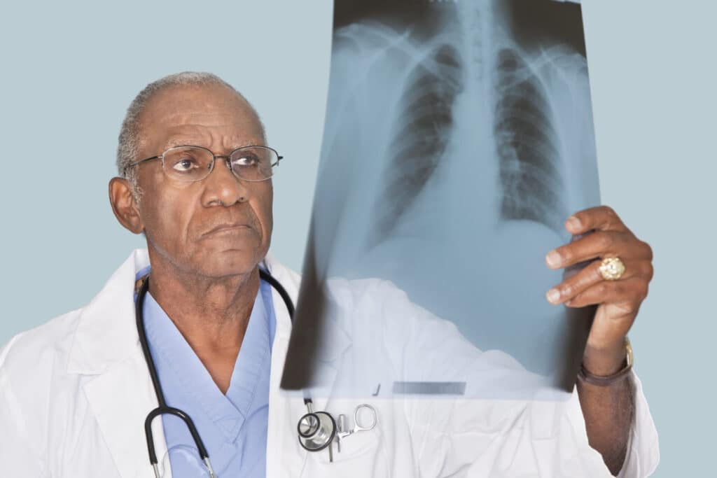 multifocal pneumonia, types of pneumonia, pneumonia types, bacterial pneumonia, viral pneumonia, fungal pneumonia, multifocal pneumonia diagnosis