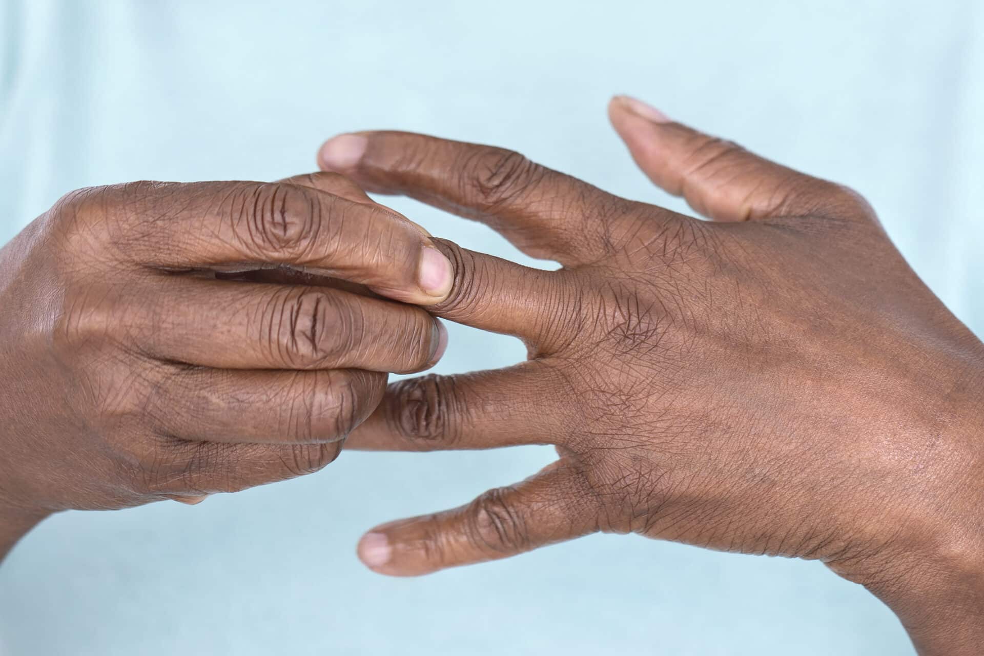 Rheumatoid arthritis, RA, autoimmune disease, global health, healthcare professionals, DALYs, disability-adjusted life years, chronic illness, health disparities, Black patients, health equity, systemic racism, access to care, treatment outcomes, early diagnosis, biologic therapies, public health, preventive care, clinical research, epidemiology, patient care, chronic pain, inflammation, joint pain, disease management, socioeconomic factors.