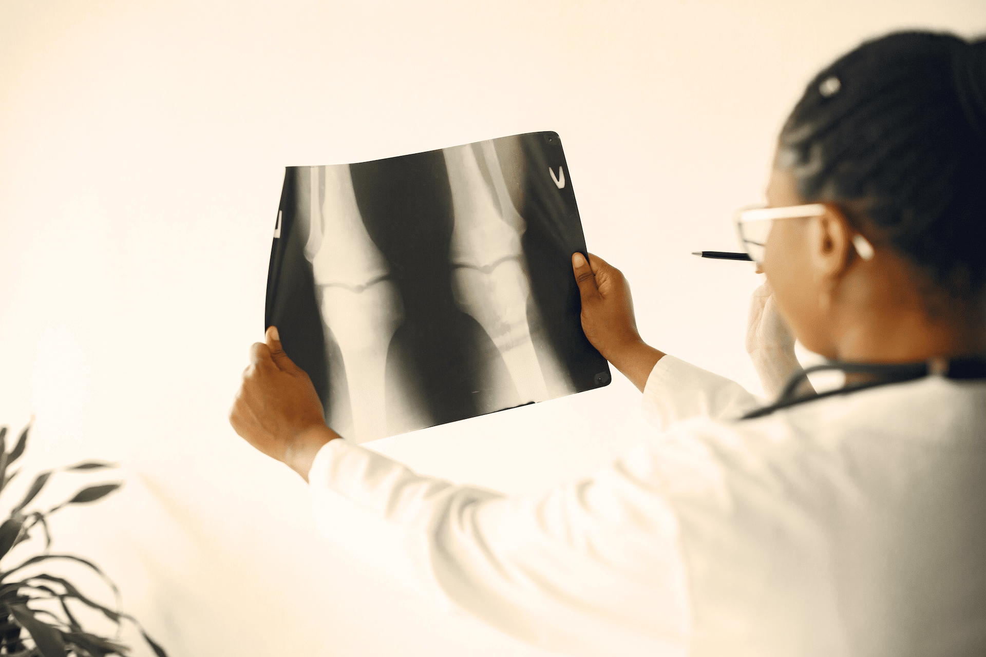 femoral bone mineral density
