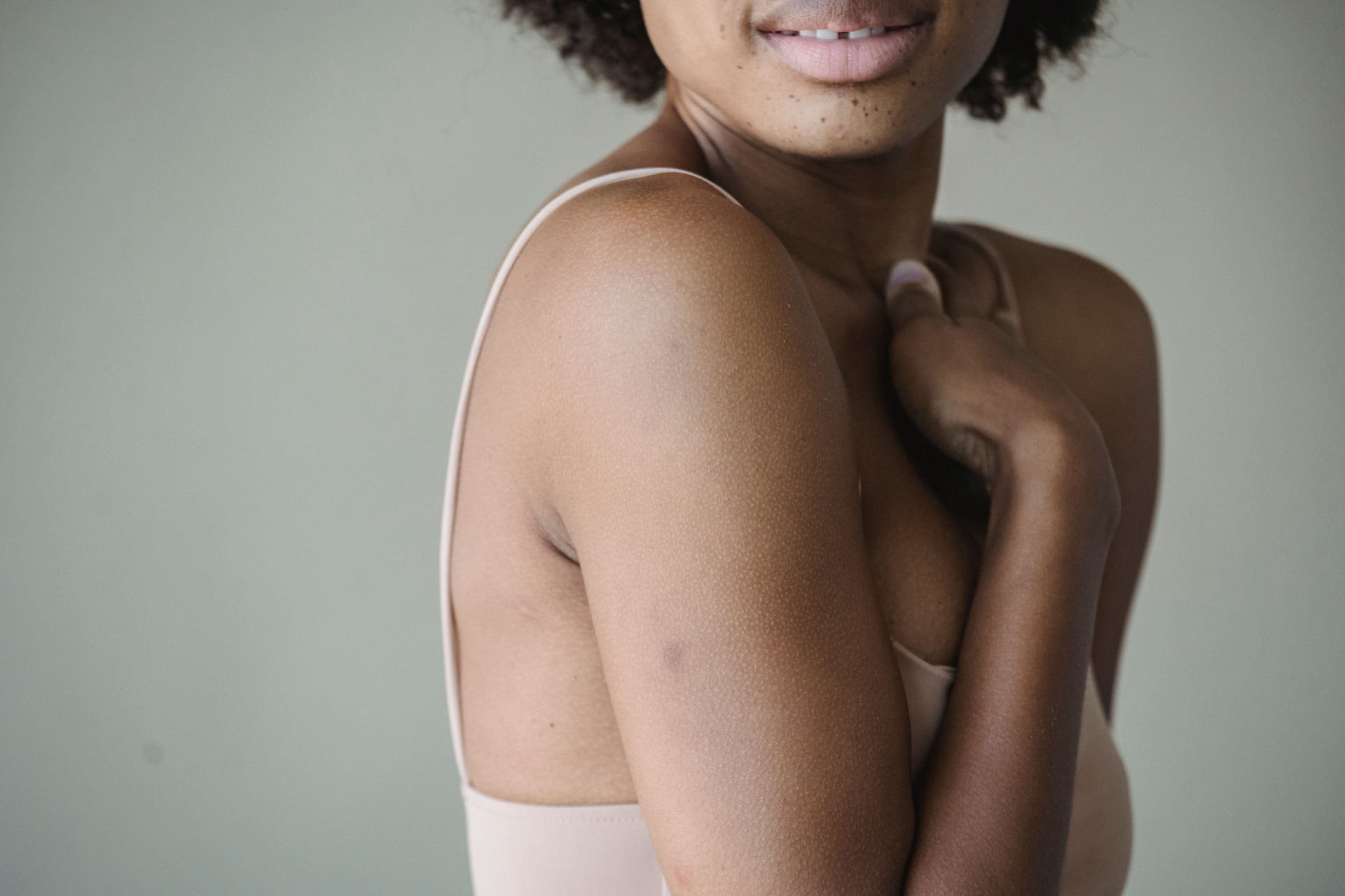 HS diagnosis Black patients
