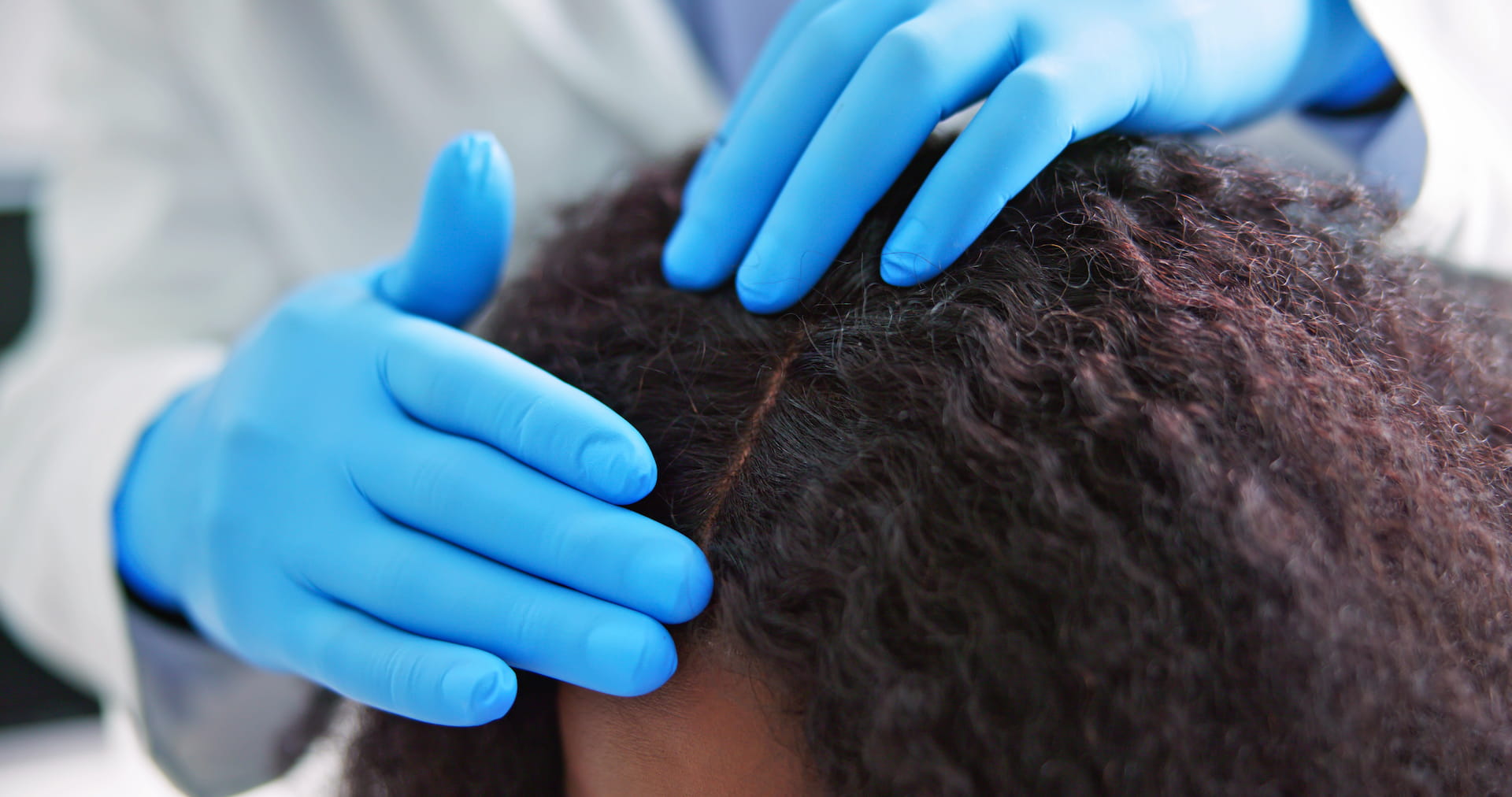 hair restoration