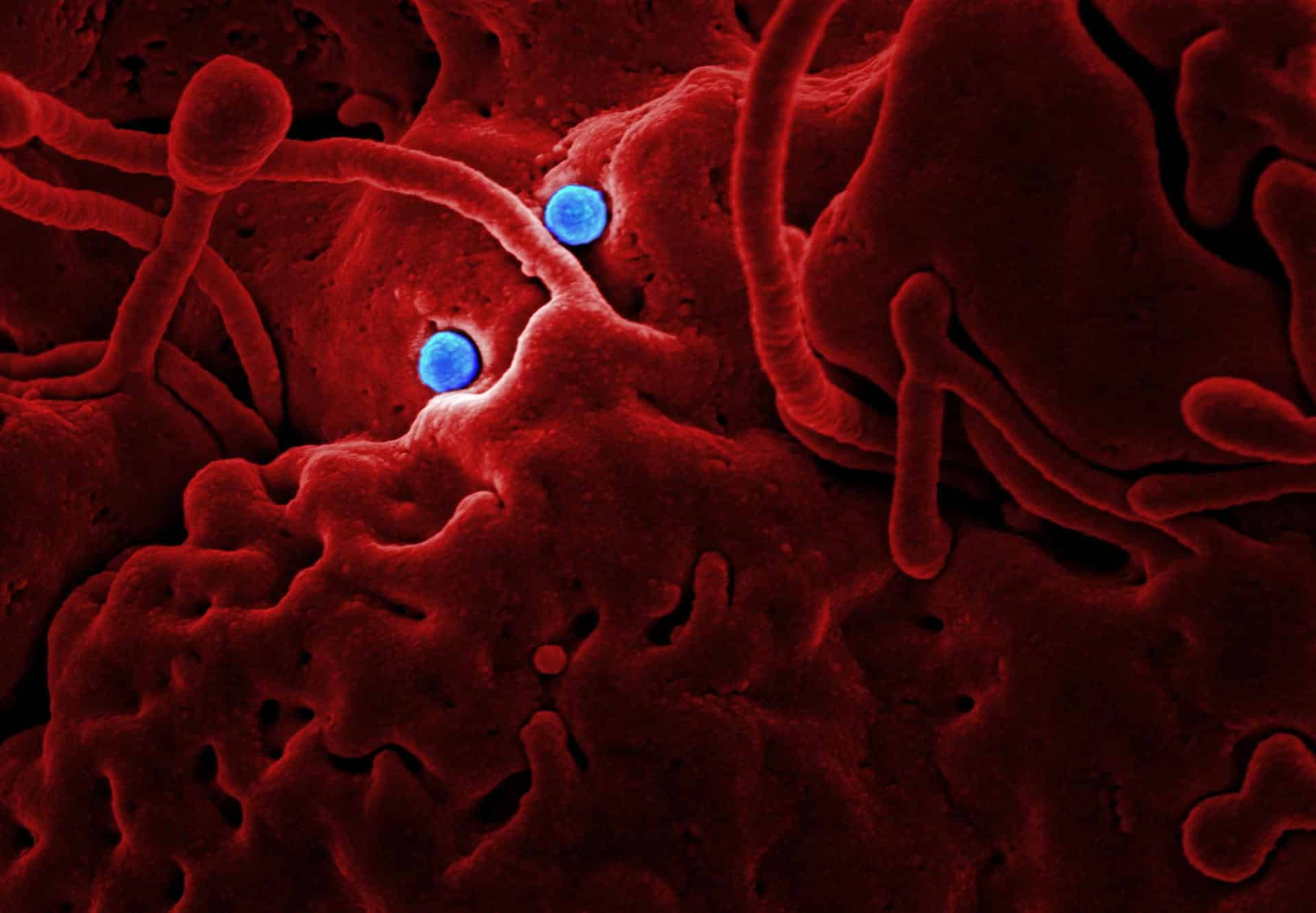 superbugs